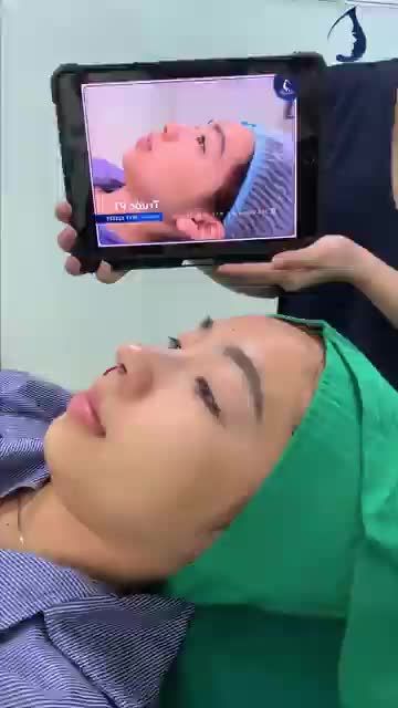 Mũi cấu trúc nhẹ nhàng tự nhiên cho em gái dân văn phòng