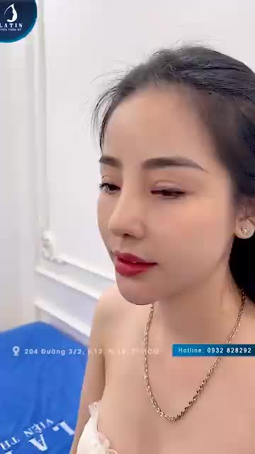 Sau lần nâng mũi trước đó không thành công, chị khách Việt kiều quyết tâm bay gần 15.000km từ Mỹ về Việt Nam sửa mũi và độn cằm
