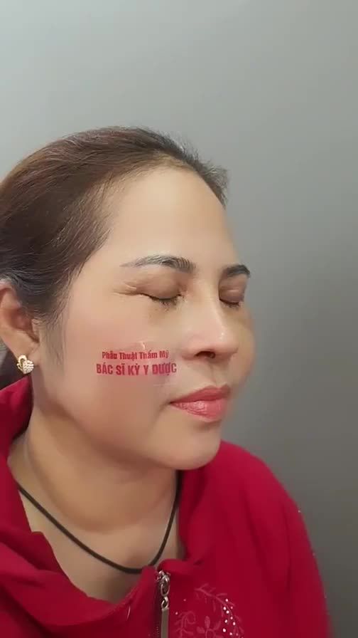 "Trộm vía từ ngày làm xong đến nay chưa biết đau là gì. Nâng mũi gì mà còn không đau bằng xăm môi nữa."