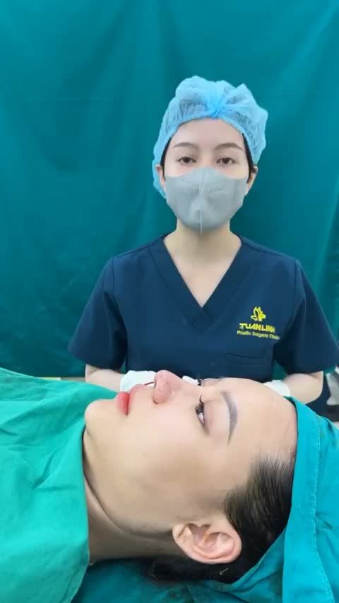Case mũi tái cấu trúc vừa hoàn thành