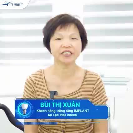 BAY TỪ SÉC VỀ VIỆT NAM ĐỂ TRỒNG RĂNG IMPLANT TOÀN HÀM TRÊN