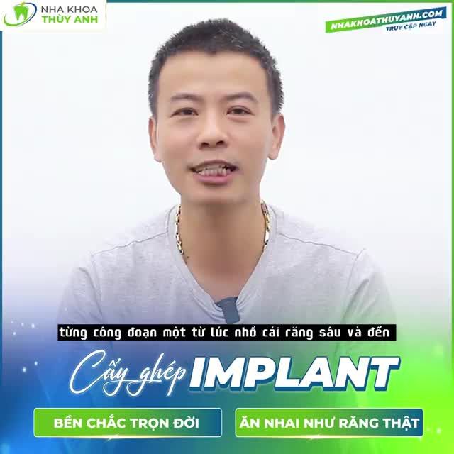 CẤY GHÉP IMPLANT - SỰ ĐẦU TƯ CHÍNH ĐÁNG CHO SỨC KHOẺ CỦA BẠN