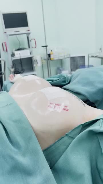 Tân trang vòng 1 cho em gái tại cơ sở ở Nha Trang