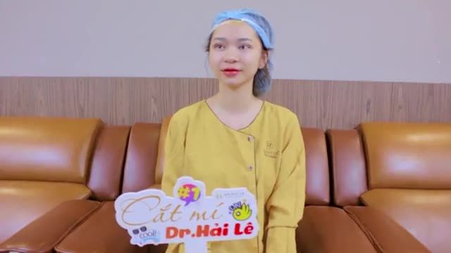 Mí mắt đẹp tự nhiên chỉ sau 45 phút cắt mí tại Dr.Hải Lê bạn có tin