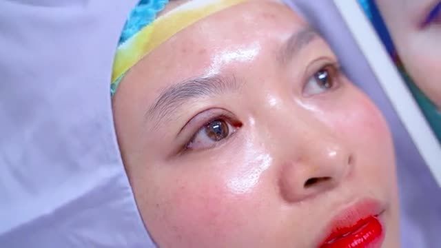 Mí mắt tại Dr.Hải Lê đẹp tự nhiên như thế nào sau 45 phút thực hiện? Cả nhà cùng theo dõi