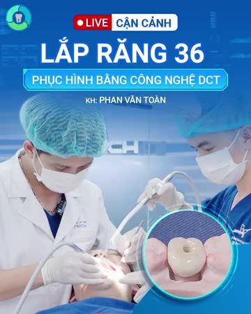Anh Phan Văn Toàn (Cầu Giấy, Hà Nội) đến với Nha khoa Lạc Việt trong tình trạng mất răng 36.