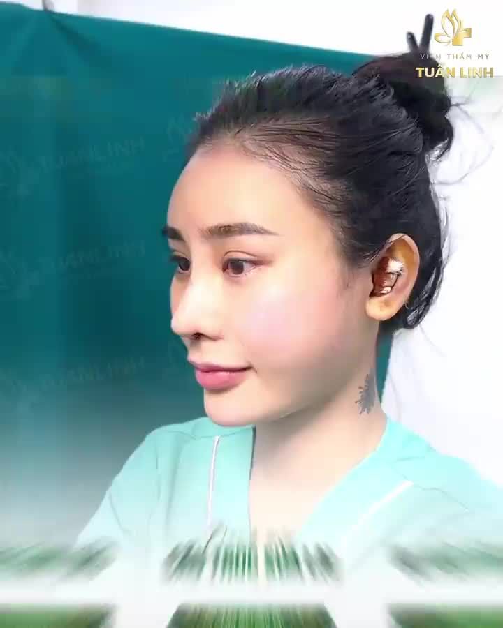Khách nói " Em thích dáng mũi cao tây, sắc nét nhưng vẫn phải tự nhiên nha bác"!! = OK em...Bác sẽ chiều em!!