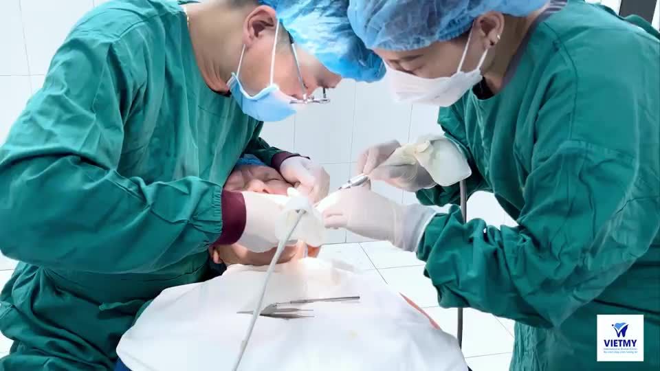 Cận cảnh quá trình đặt trụ Implant R36 cho khách hàng Nguyễn Văn Ninh. Do trực tiếp bác sĩ Lê Thiên Quế tại Nha khoa Quốc tế Việt Mỹ thực hiện!!