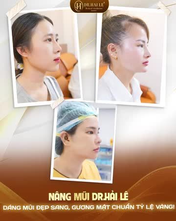 Mũi là bộ phận trung tâm, quyết định phần lớn tỷ lệ gương mặt!