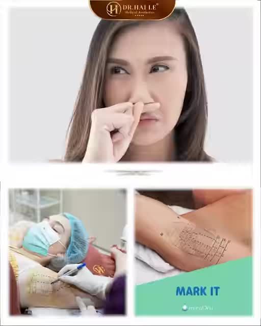 Hết hôi nách, khách hàng dễ dàng chốt đơn - Inbox nhận tư vấn và ưu đãi HOT từ Dr.Hải Lê!
