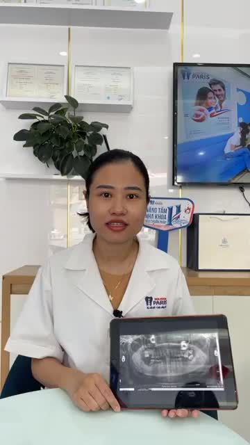 Talk show cùng bác sĩ Thanh Huyền chia sẻ về dịch vụ trồng răng cấy ghép implant tại nha khoa Paris Vinh