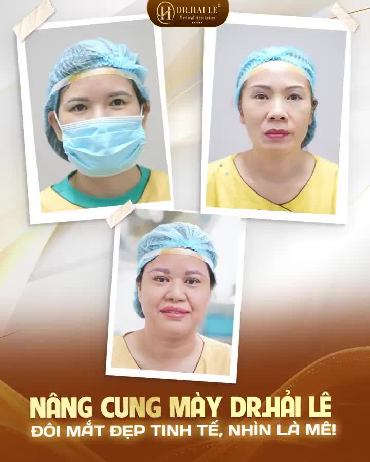 Làm sao để lấy lại đôi mắt "tuổi thanh xuân" cho các chị em đây?