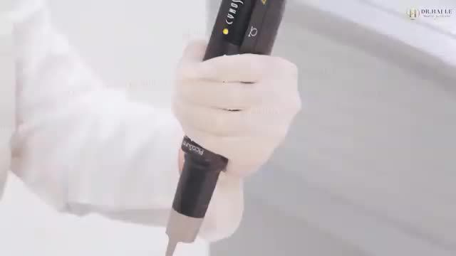 PicoSure Pro là hệ thống Laser Pico đầu tiên và duy nhất trên thế giới được FDA (Hoa Kỳ) chứng nhận trong việc điều trị Nám Melasma, Nám Hơ ri, Bớt Ota.