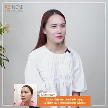 Cô nàng kinh doanh thời trang chia sẻ về "cuộc sống mới" sau 3 tháng nâng mũi
