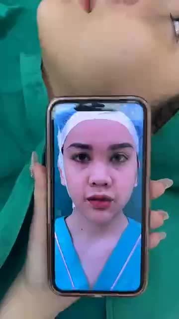 Case mũi cấu trúc vừa hoàn thành
