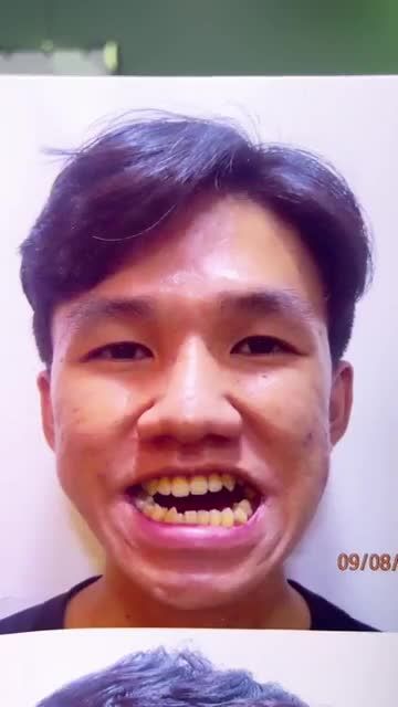CẮT HÀM ĐỔI ĐỜI nam sinh Gen Z hóa tài tử điện ảnh Hàn Quốc say đắm lòng chị em