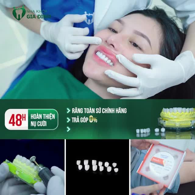 48H THẨM MỸ RĂNG SỨ KHÔNG MÀI NHỎ