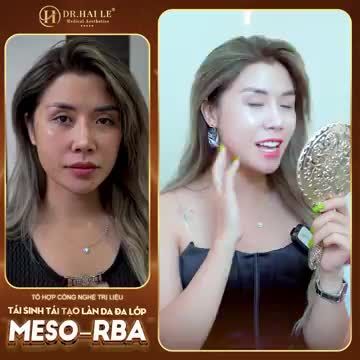 Làn da thay đổi "ngoạn mục", xóa mờ khuyết điểm với Meso- RBA Dr Hải Lê, còn chần chừ gì mà không trải nghiệm ngay hôm nay?