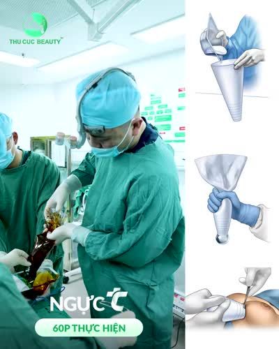 Nâng cấp V1 an toàn sau 60P - Hồi phục nhanh chóng sau 07 ngày