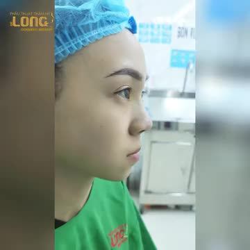 Ẩn sau lớp khẩu trang sẽ khiến bạn ngã ngửa vì….dáng mũi