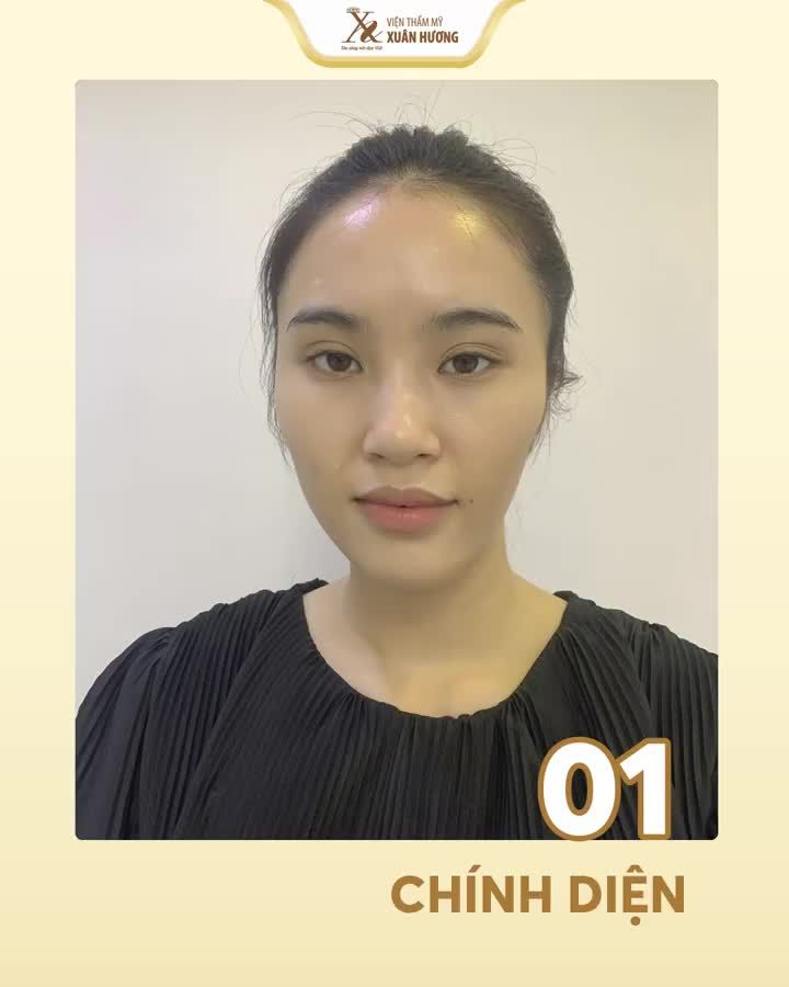GỬI HÌNH ẢNH GƯƠNG MẶT - NHẬN TƯ VẤN CHI TIẾT TỪ BÁC SĨ