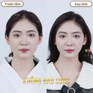 VLINE PERFECT - THẦN THÁI CAO SANG CUỐN HÚT