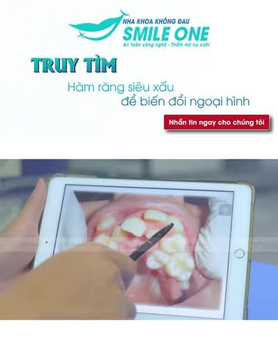 Cần tìm những hàm răng xấu nhất Hà Nội để biến hoá trở nên đẹp hơn!