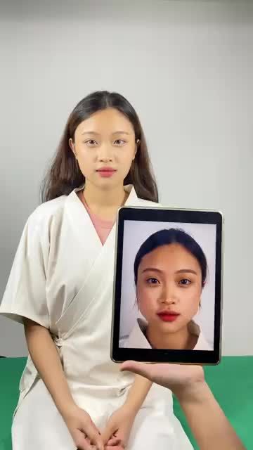 KHÁCH HÀNG LÀM VLINE PERFECT QUAY TRỞ LẠI TÁI KHÁM SAU 2 THÁNG