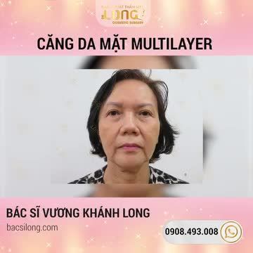 DA ĐẸP MÊ SAY CHỐT DEAL LIỀN TAY