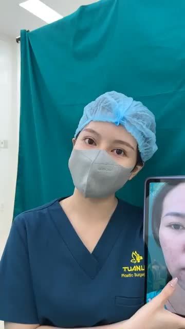 Case mũi cấu trúc vừa hoàn thành