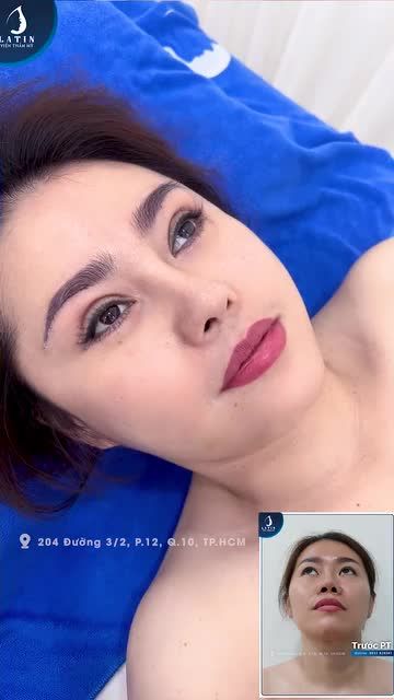 Từ Mỹ về Việt Nam làm đẹp cần bao nhiêu thời gian