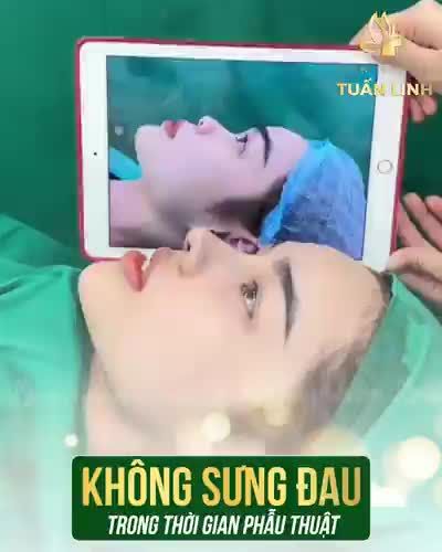 Tại sao dịch vụ nâng mũi tại Tuấn Linh luôn được đông đảo các bạn lựa chọn