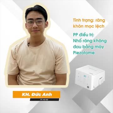 ƯU ĐÃI TỚI 30% LOẠI BỎ RĂNG KHÔN, CHẲNG LO ĐAU NHỨC