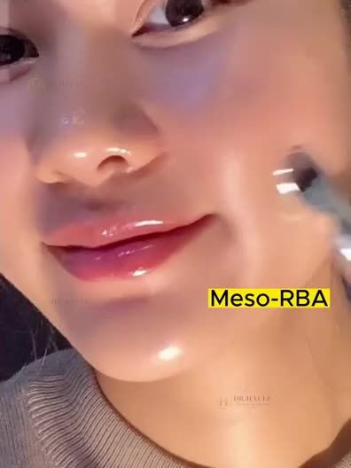 Picosure Pro kết hợp với các công nghệ còn lại mang đến hiệu quả trị liệu tận gốc vấn đề đến vấn đề gặp phải, mang đến một làn da căng-trắng-sáng-bóng-mịn.