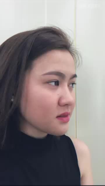 NÂNG MŨI - 1 QUYẾT ĐỊNH THAY ĐỔI TẤT CẢ