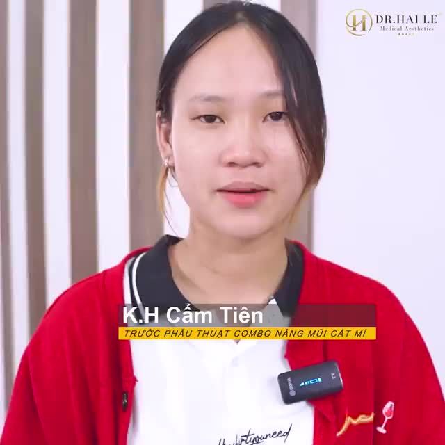 Mắt 2 mí rặng rỡ, dáng mũi cao tựa nàng thơ