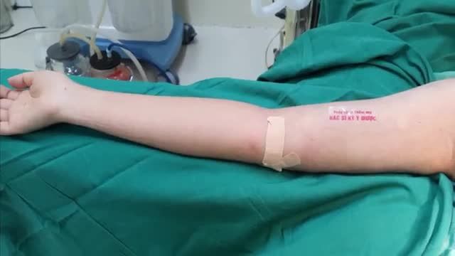 Bắp tay lỏng lẻo nhiều mỡ khiến bạn tự ti khi diện áo 2 dây.