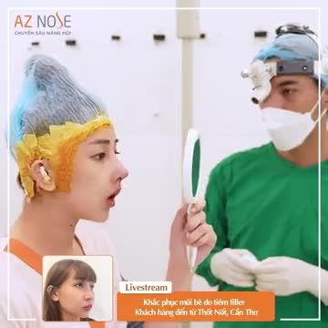 Dáng mũi từng ti.êm filler được cải thiện thế nào sau khi nâng mũi cấu trúc?