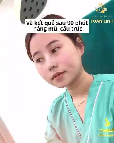 Da mũi mỏng, trụ mũi yếu, sống mũi gồ, thấp tẹt...Nâng lên liệu có CAO được không?