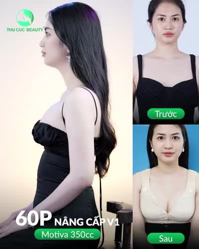 NÂNG V1 CHỈ 60P VỚI TÚI MOTIVA CHÍNH HÃNG: