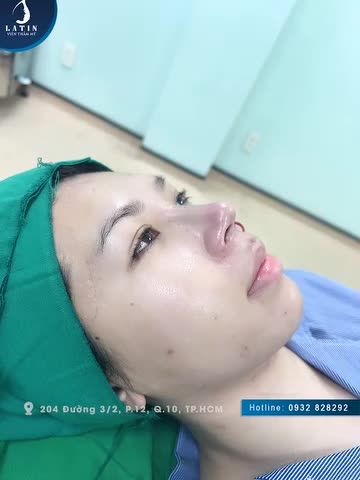 Bạn nào thích dáng mũi cao bay tự nhiên thì xem ngay video này.