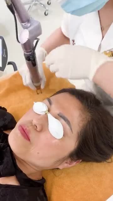 Đỉnh cao hút mực xăm mày tại Xuân Hương
