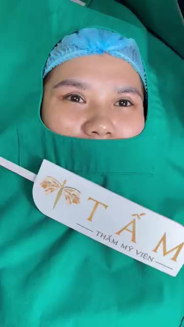 Sau nâng cung mày, mắt chị khách hàng đã rõ nếp mí