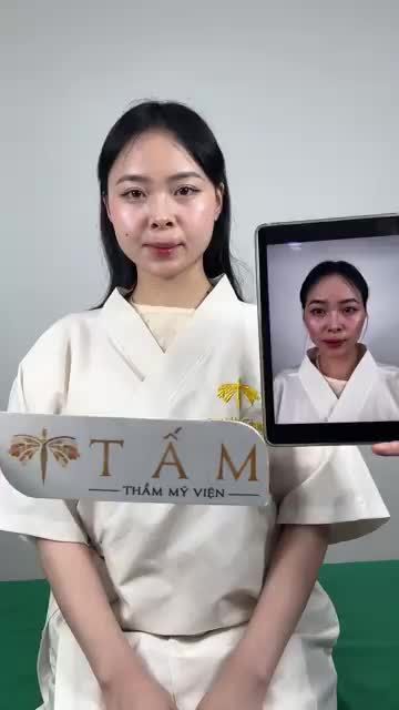 Bạn khách Phương Oanh gặp phải tình trạng má hóp diện rộng, thái dương hõm khiến gương mặt hốc hác, thiếu sức sống.