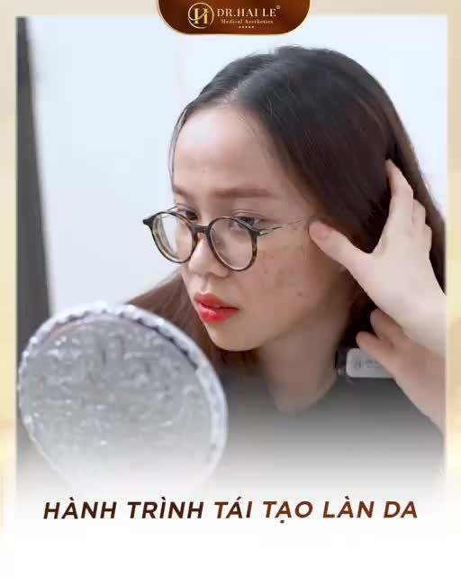 Meso-RBA Dr.Hải Lê, sở hữu làn da khỏe xinh chỉ sau 1 liệu trình