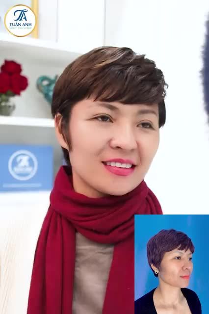 LỰA CHỌN ĐÚNG ĐỊA CHỈ ĐỘN THÁI DƯƠNG UY TÍN - KHÁCH HÀNG VÔ CÙNG HÀI LÒNG VỀ KẾT QUẢ