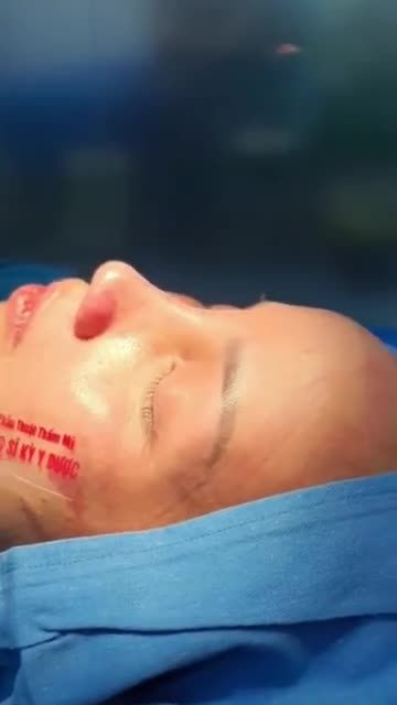 Dáng mũi ALINE có độ cao phù hợp với từng khuôn mặt.