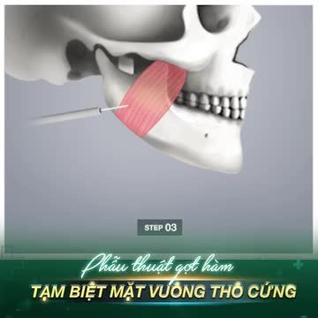 TẠM BIỆT MẶT VUÔNG THÔ CỨNG