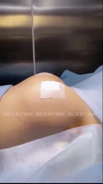 Phẫu thuật được thực hiện tại bệnh viện đạt chuẩn 5 sao