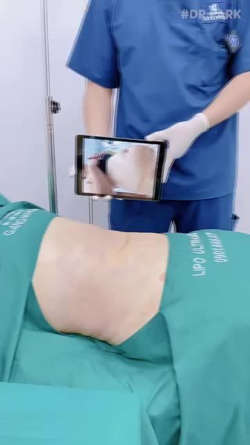 BỤNG QUÁ NHIỀU MỠ - HÚT MỠ NHANH ĐỂ BẢO VỆ CƠ THỂ